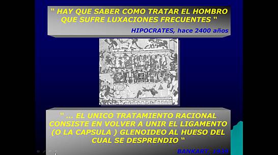 Inestabilidad Gleno-Humeral